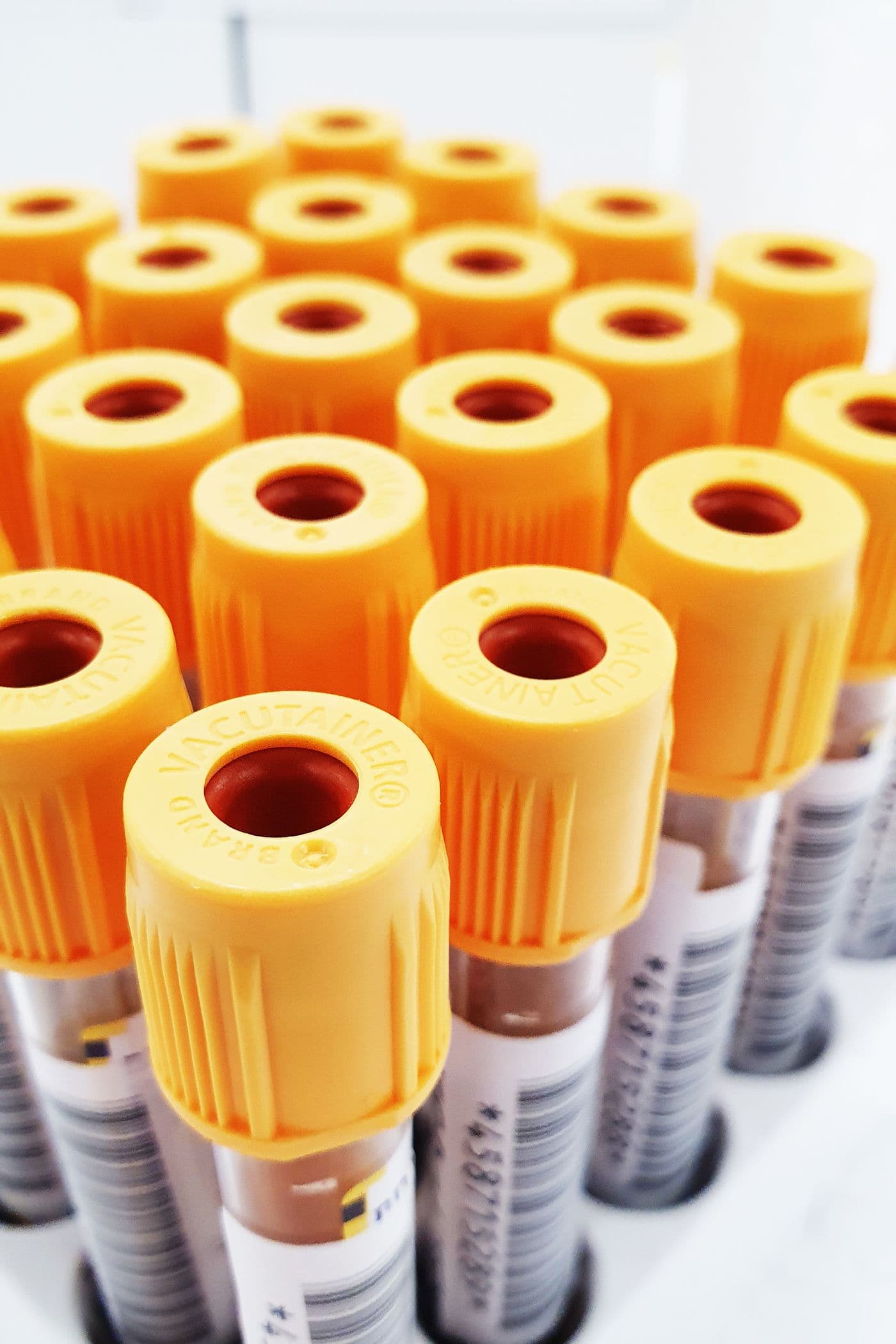 Blood sample tubes prepared for laboratory testing